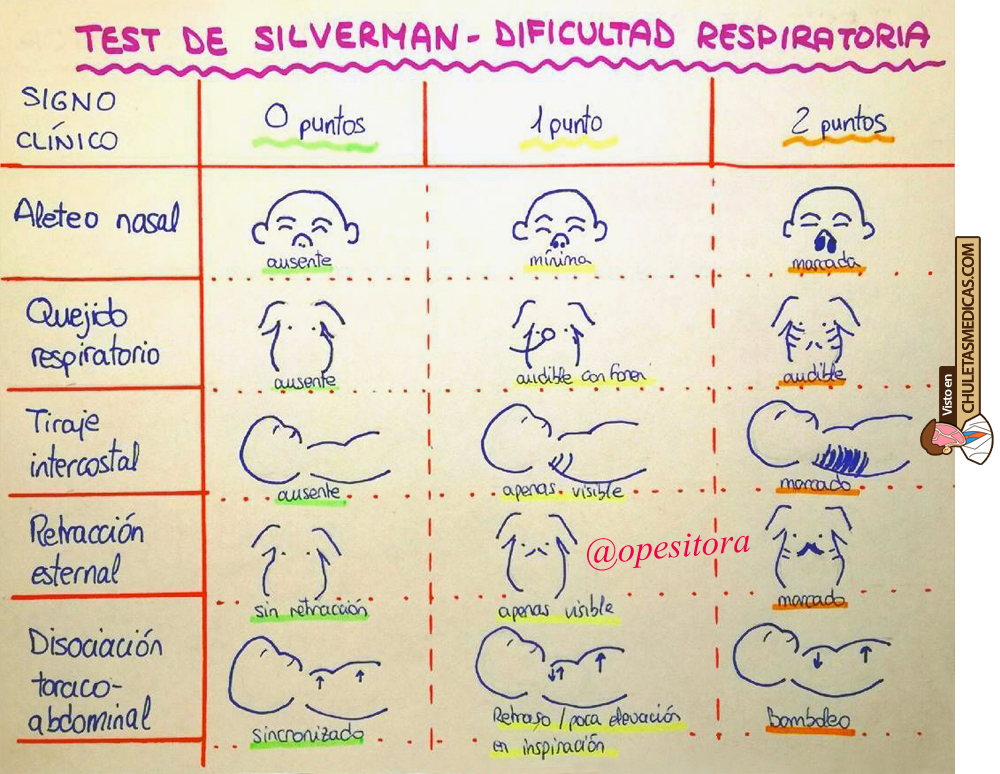 Escala de Silverman en la dificultad respiratoria Neonatal Chuleta