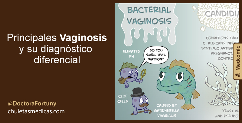 Principales Vaginosis y su diagnóstico diferencial