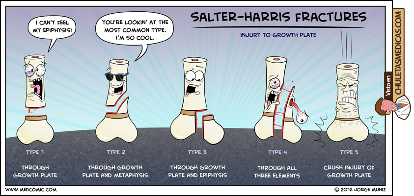 Clasificación de Salter-Harris para la epifisiolisis chuleta