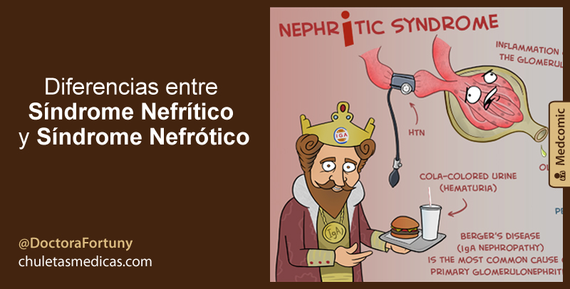 Diferencias entre Síndrome Nefrítico y Síndrome Nefrótico