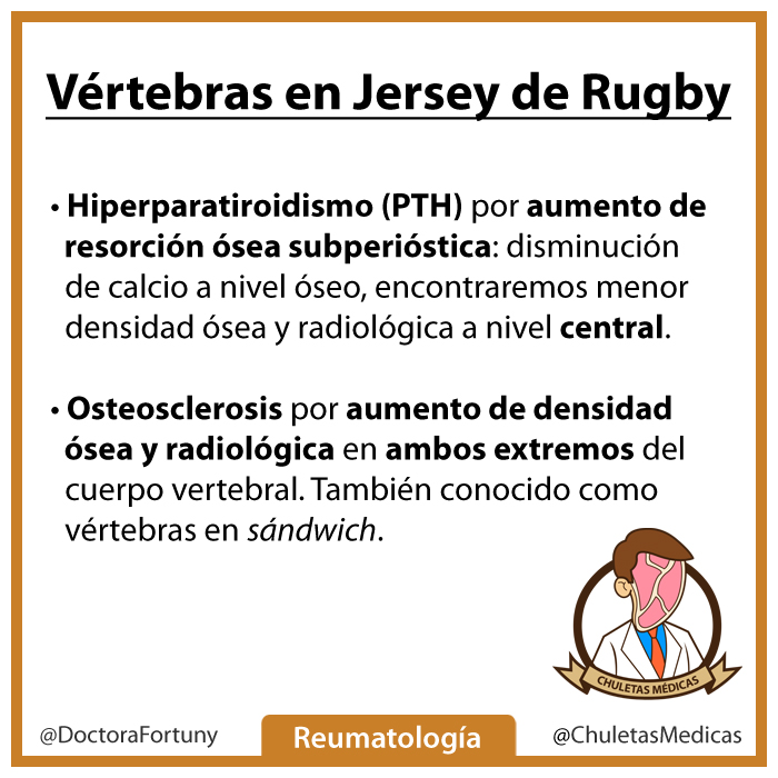 Vértebras en jersey de rugby chuleta