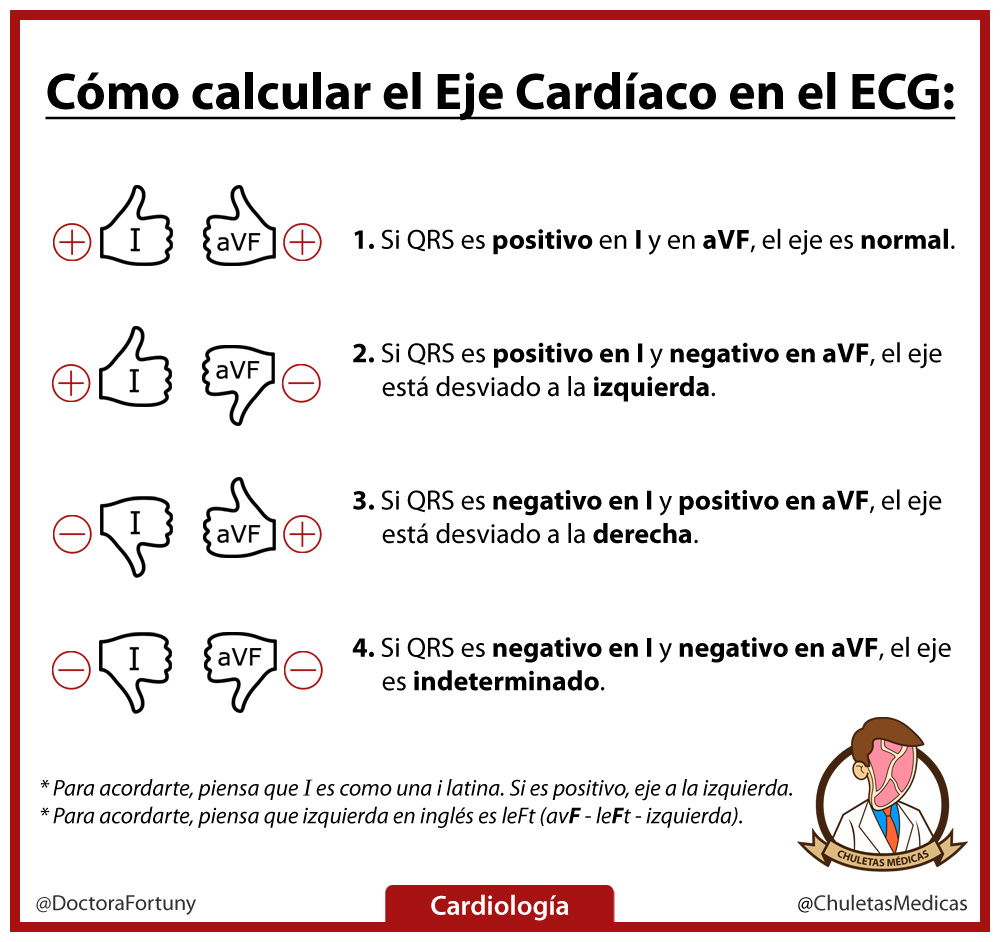 ¿Cómo Calcular el Eje Cardíaco en ECG? chuleta