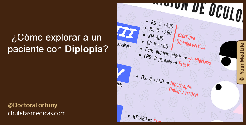 ¿Cómo explorar a un paciente con Diplopía?