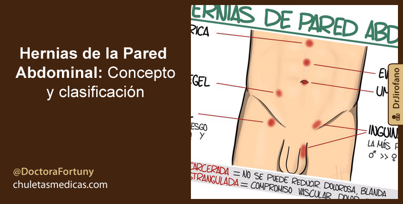 Hernias de la Pared Abdominal: Concepto y clasificación